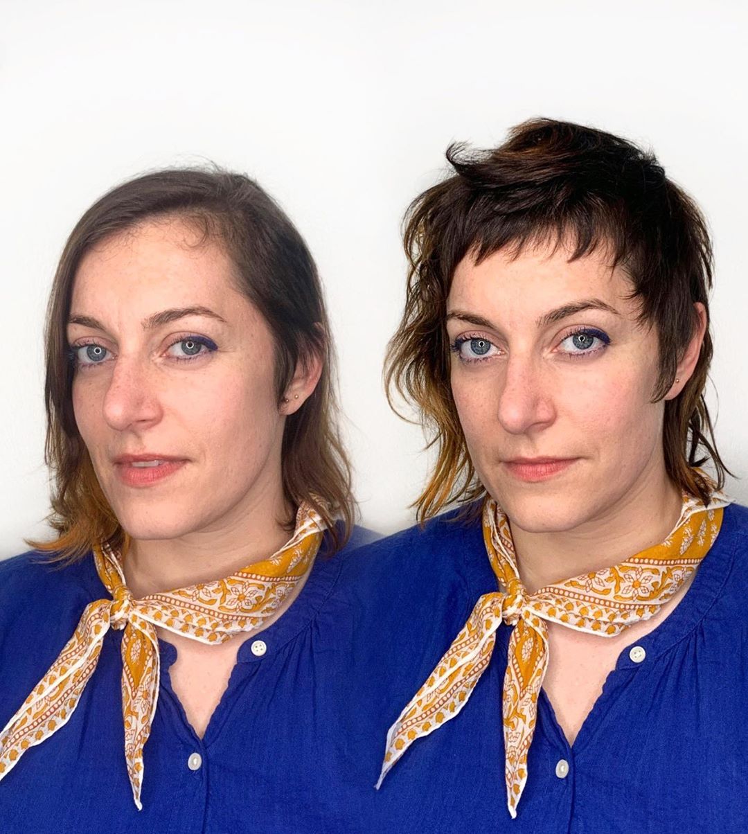 Receding Hairline in Women, Best Hairstyles for Receding Hairline in 2023 Receding Hairline in Women, Best Hairstyles for Receding Hairline in 2023